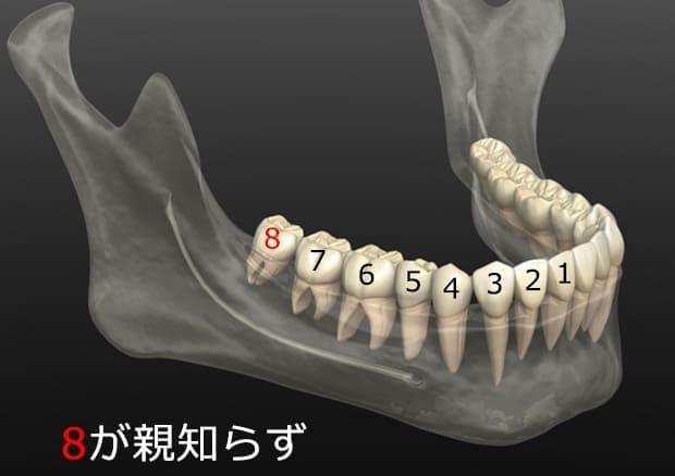 親知らずとは？